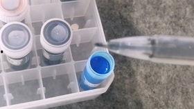 成人拔牙齿的视频大全,成人拔牙全过程视频大全  第3张